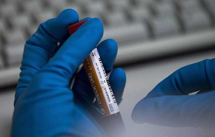 ۳ دوپینگ جدید/محرومیت پدیده وزن حسن یزدانی